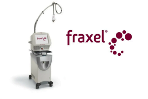 fraxel